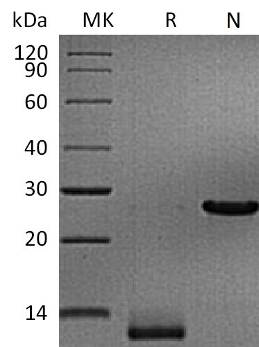 Human-Mouse-Rat TGF-beta 3+SDS-PAGE.jpg
